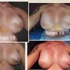 Musculo del pecho subido