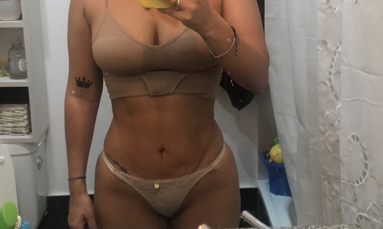Lipo marcación, corrección de cicatriz y lipo transferencia. - 8432