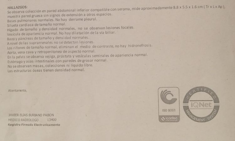 Seroma tardío que ahora smes cicatriz queloide. - 8477