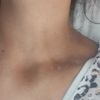 Cuello con color oscuro