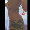 Liposucción o lipoescultura en la parte inferior de la espalda? - 12502