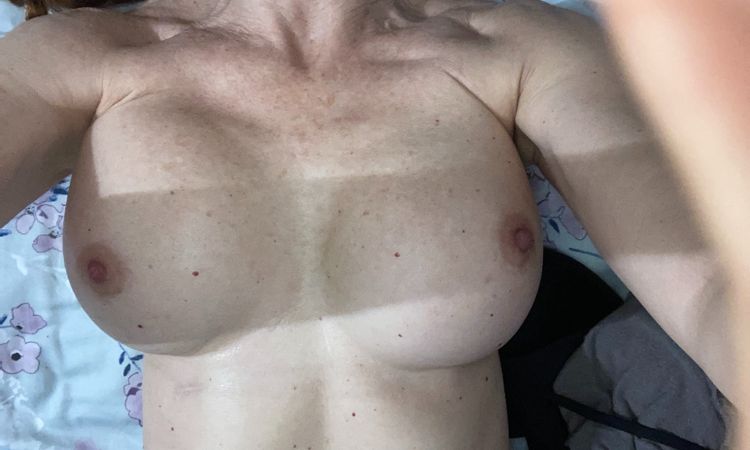 Capsulorrafia resultados - 16617