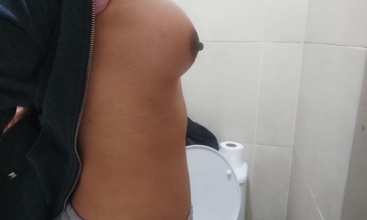 Pezones muy abajo Despues de una cirujía de mamas - 44041