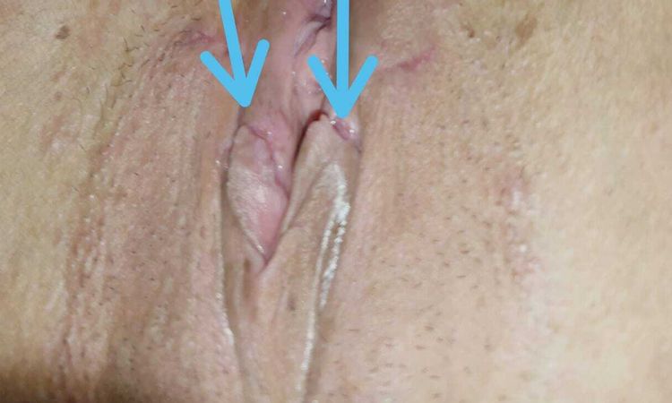 Labios menores partidos - 45696