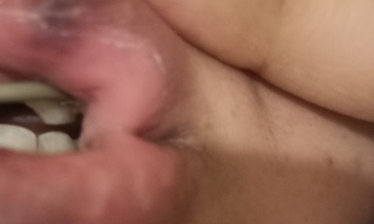 Posible necrosis tras aumento de labios - 47025