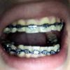 Necesito una segunda opinión de ortodoncia - 47994