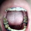 Necesito una segunda opinión de ortodoncia