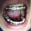 Necesito una segunda opinión de ortodoncia - 47996