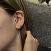 Cerrar agujero oreja