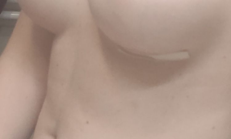 Puede ser doble surco o solo es porque estoy gordita?? - 50446