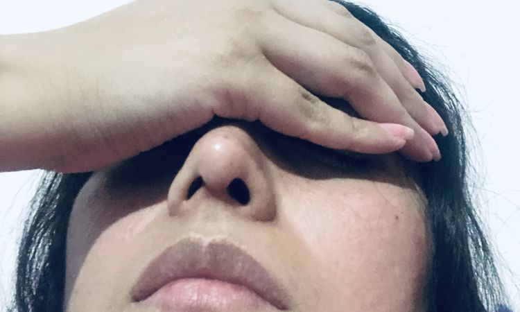 Fosa nasal pequeña después de rinoplastia, tiene solución? - 50677