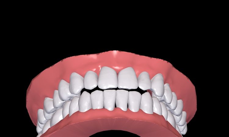 Resultados de simulación 3d Dr Smile - 51245