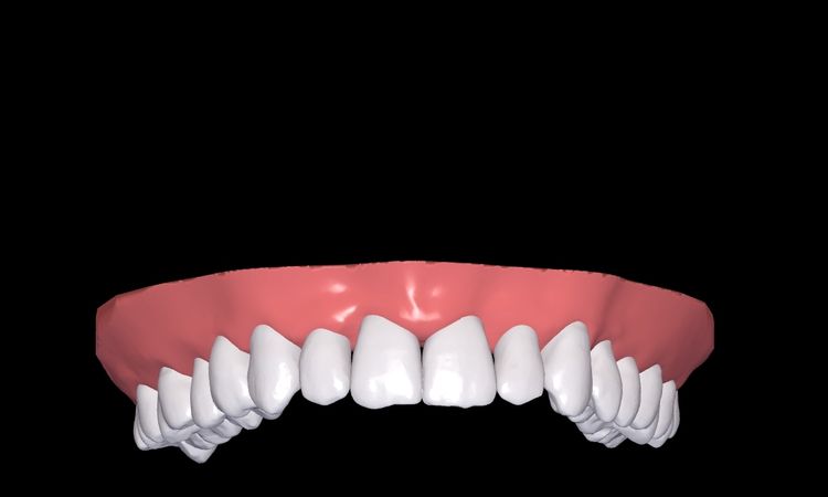 Resultados de simulación 3d Dr Smile - 51246