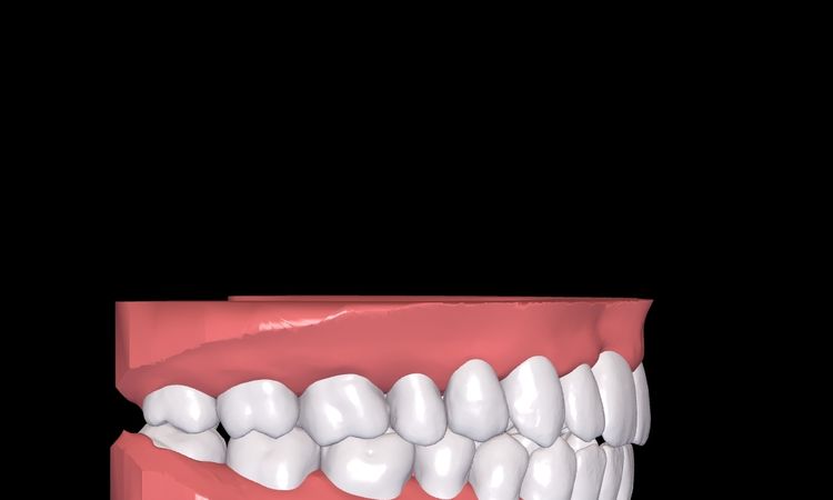 Resultados de simulación 3d Dr Smile - 51247