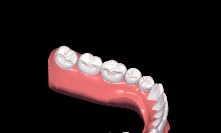 Resultados de simulación 3d Dr Smile - 51249