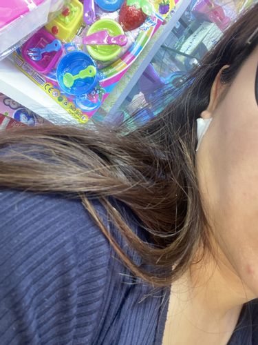 Recuperar la grasa en la zona tras lipomarcación mandibular