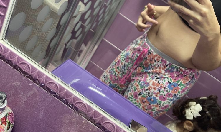 Inflamación estomacal, estreñimiento y vómitos 2 meses tras abdominoplastia - 53076
