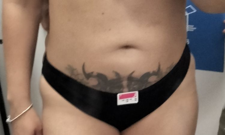 El peso en la báscula no cambia nunca después de Lipo Vaser - 54770