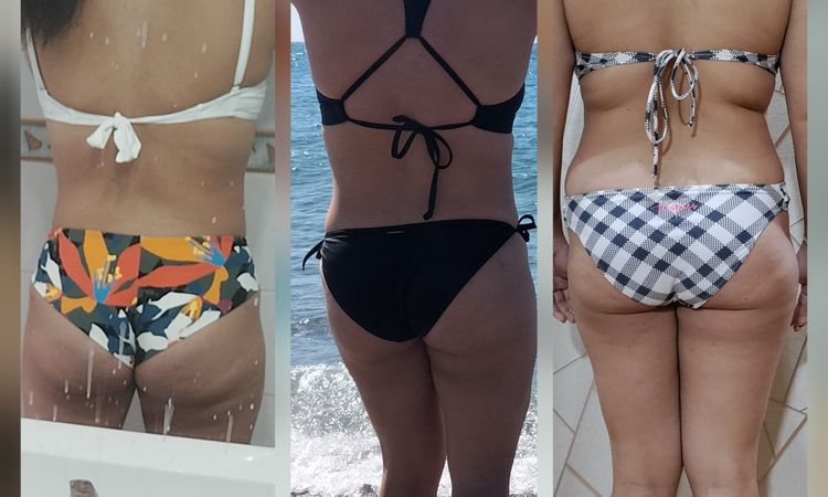 El peso en la báscula no cambia nunca después de Lipo Vaser - 54771