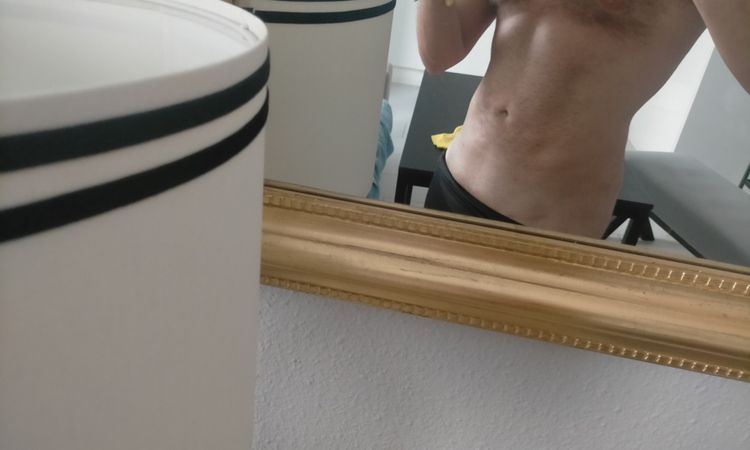 Corregir fibrosis lipo abdominal y depresiones - 55072