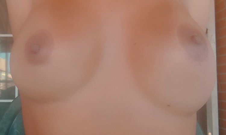 Recambio de prótesis por bottoming out, y cómo prevenirlo - 56509