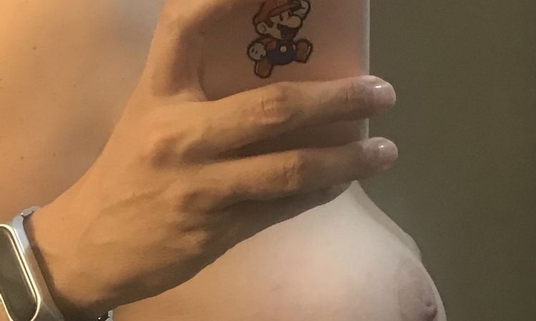 Pecho caído tras 8 meses de mastopexia con implantes 335cc motiva full - 57357
