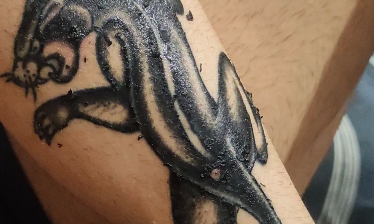 ¿Cuánto tiempo tengo que esperar para tatuarme la cicatriz de un lunar? - 57884