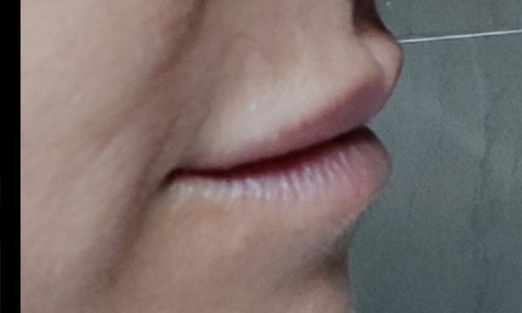 Restyline Volyme para aumento de labios - 60093