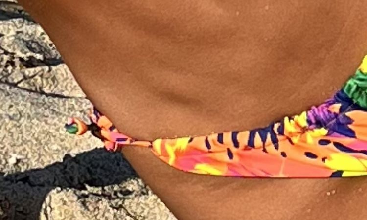 Tras 2 años de liposucción: cómo mejorar el aspecto del abdomen? - 61213
