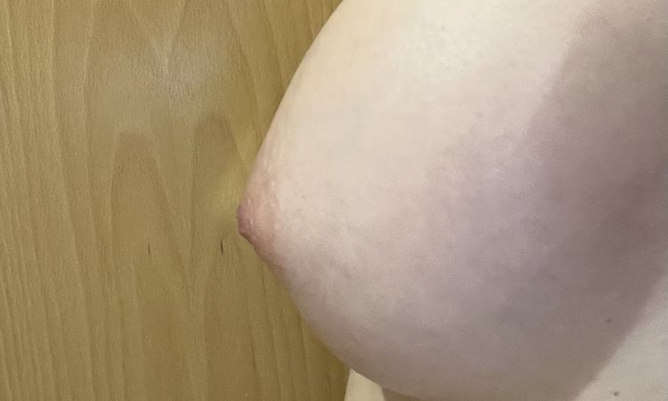 Pecho en forma de gota 7 meses después de mi aumento - 61341