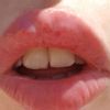Relleno de labios irritación y picor