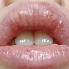 Relleno de labios irritación y picor - 62036