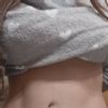 Abdominoplastia despues de 2 años