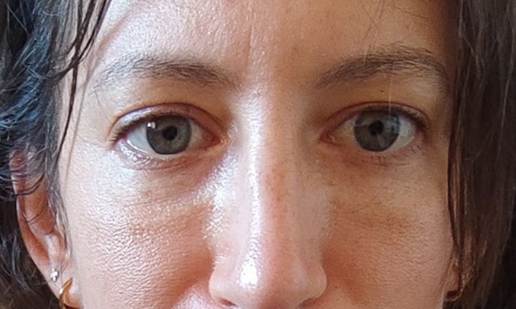 Efecto Tyndal en ojeras? - 63677