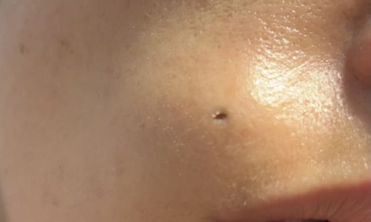 Agujero en la cara, parece un pircing - 63941