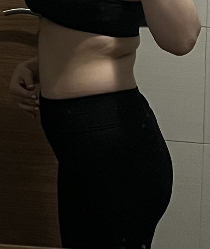 Emsculpt es una buena opción para eliminar grasa abdominal?