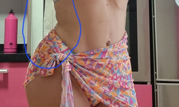 Liposucción con bodytime resultados negativos - 66022