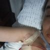 Cama hiperbárica por pexia mamaria