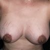 Tengo 330 y me las veo pequeñas y caidas
