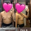 Creen que hay posibilidad de que el implante derecho baje?