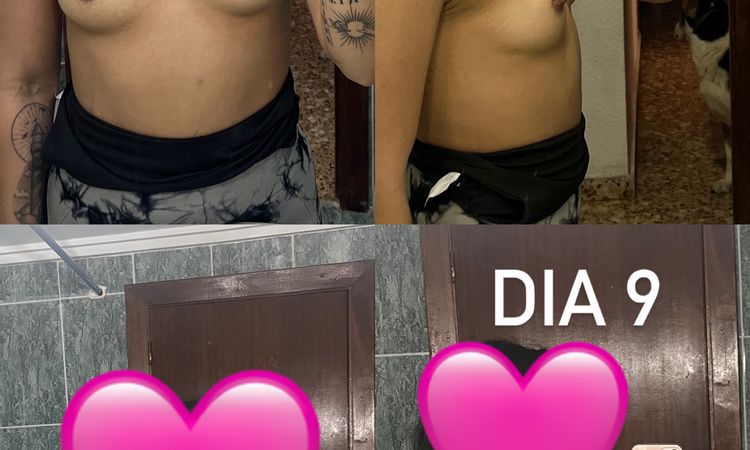 Creen que hay posibilidad de que el implante derecho baje? - 74460