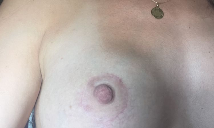 Diferentes cc entre un pecho y otro. - 76343
