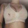 Post operatorio de pechos, tengo calor en los pezones!