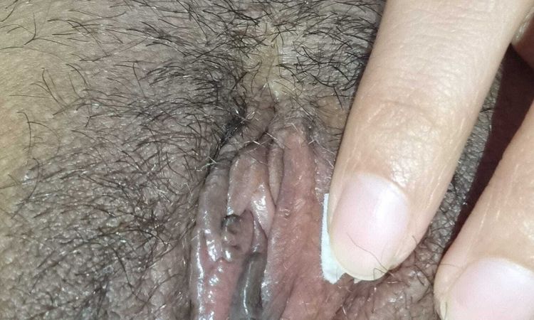 Unir pliegues de la labioplastia - 80491