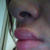 ¿Que tiene que ver un resfrío con que se hinchen los labios ?