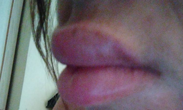 ¿Que tiene que ver un resfrío con que se hinchen los labios ? - 81162