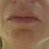 Abultamiento sobre el labio y lados desiguales