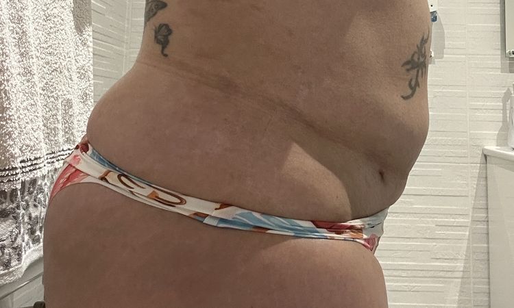 ¿Puede ser inflamación intestinal como dice mi doctora? - 81844
