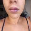 Mañana hace una semana que me pinché los labios