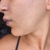 Mañana hace una semana que me pinché los labios